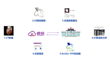 冠狀動(dòng)脈供血功能評估軟件（FFR）（深圳睿心）