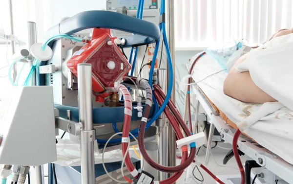 熱點(diǎn) | 填補(bǔ)國產(chǎn)空白，ECMO迎來“中國造”